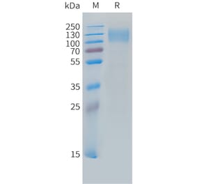 SDS-PAGE - Recombinant Cynomolgus macaque CEACAM5 Protein (10xHis Tag) (A324710) - Antibodies.com