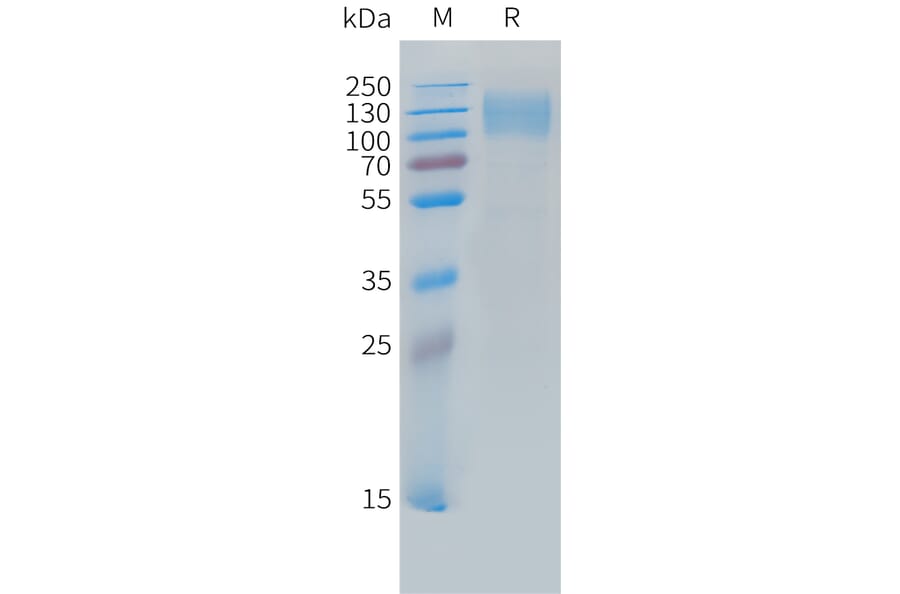SDS-PAGE - Recombinant Cynomolgus macaque CEACAM5 Protein (10xHis Tag) (A324710) - Antibodies.com