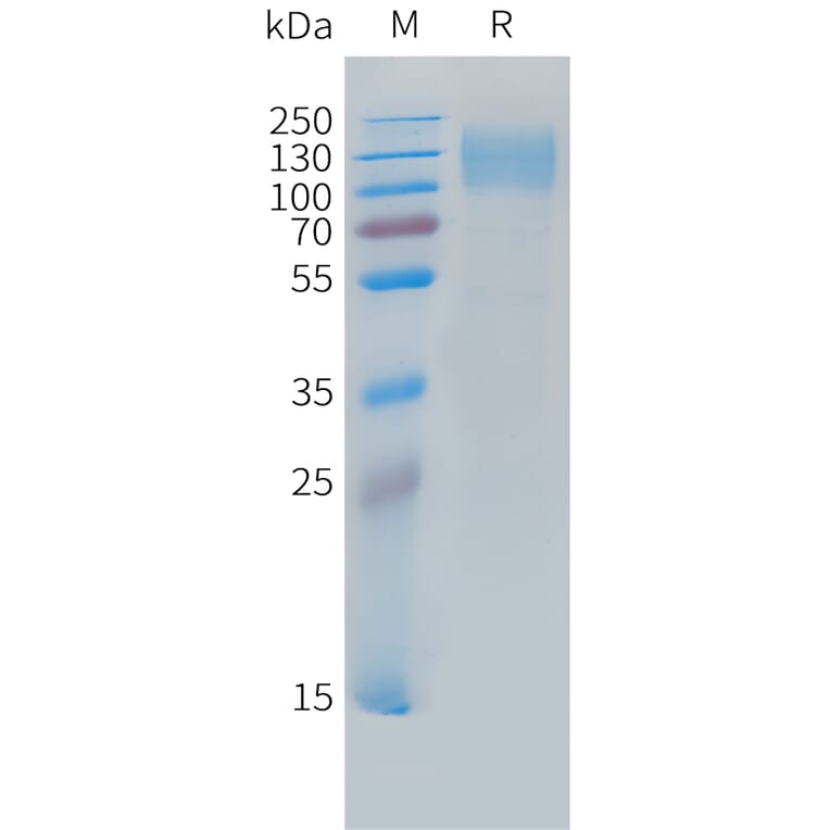 SDS-PAGE - Recombinant Cynomolgus macaque CEACAM5 Protein (10xHis Tag) (A324710) - Antibodies.com