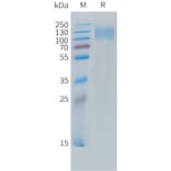SDS-PAGE - Recombinant Cynomolgus macaque CEACAM5 Protein (10xHis Tag) (A324710) - Antibodies.com