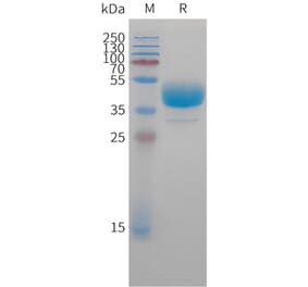 SDS-PAGE - Recombinant Cynomolgus macaque CXCR3 Protein (Fc Tag) (A324711) - Antibodies.com