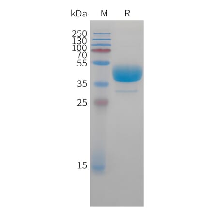 SDS-PAGE - Recombinant Cynomolgus macaque CXCR3 Protein (Fc Tag) (A324711) - Antibodies.com