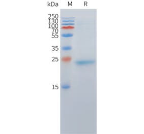 SDS-PAGE - Recombinant Cynomolgus macaque DLL3 Protein (10xHis Tag) (A324712) - Antibodies.com