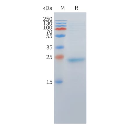 SDS-PAGE - Recombinant Cynomolgus macaque DLL3 Protein (10xHis Tag) (A324712) - Antibodies.com