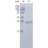 SDS-PAGE - Recombinant Cynomolgus macaque DLL3 Protein (10xHis Tag) (A324712) - Antibodies.com