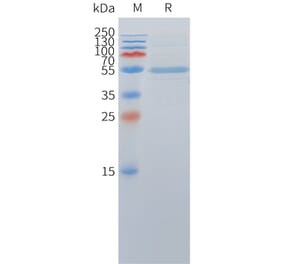 SDS-PAGE - Recombinant Cynomolgus macaque DLL3 Protein (Fc Tag) (A324713) - Antibodies.com