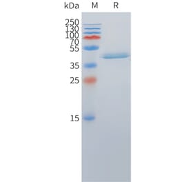 SDS-PAGE - Recombinant Cynomolgus macaque DLL3 Protein (Fc Tag) (A324714) - Antibodies.com