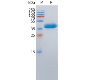 SDS-PAGE - Recombinant Cynomolgus macaque DLL3 Protein (Fc Tag) (A324715) - Antibodies.com