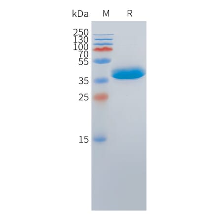 SDS-PAGE - Recombinant Cynomolgus macaque DLL3 Protein (Fc Tag) (A324715) - Antibodies.com