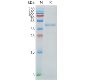 SDS-PAGE - Recombinant Cynomolgus macaque DLL3 Protein (Fc Tag) (A324716) - Antibodies.com