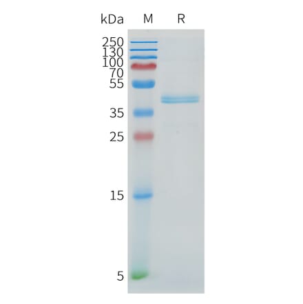 SDS-PAGE - Recombinant Cynomolgus macaque DLL3 Protein (Fc Tag) (A324716) - Antibodies.com
