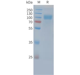 SDS-PAGE - Recombinant Cynomolgus macaque EGFR Protein (10xHis Tag) (A324717) - Antibodies.com