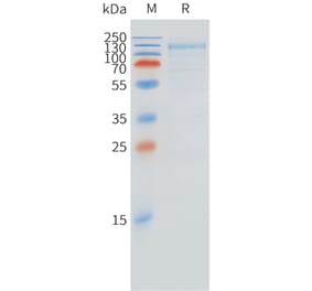 SDS-PAGE - Recombinant Cynomolgus macaque FCRL5 Protein (10xHis Tag) (A324718) - Antibodies.com