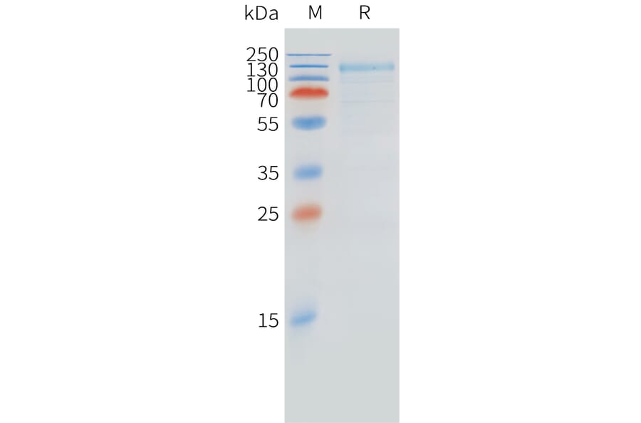SDS-PAGE - Recombinant Cynomolgus macaque FCRL5 Protein (10xHis Tag) (A324718) - Antibodies.com