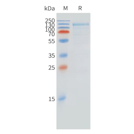 SDS-PAGE - Recombinant Cynomolgus macaque FCRL5 Protein (10xHis Tag) (A324718) - Antibodies.com