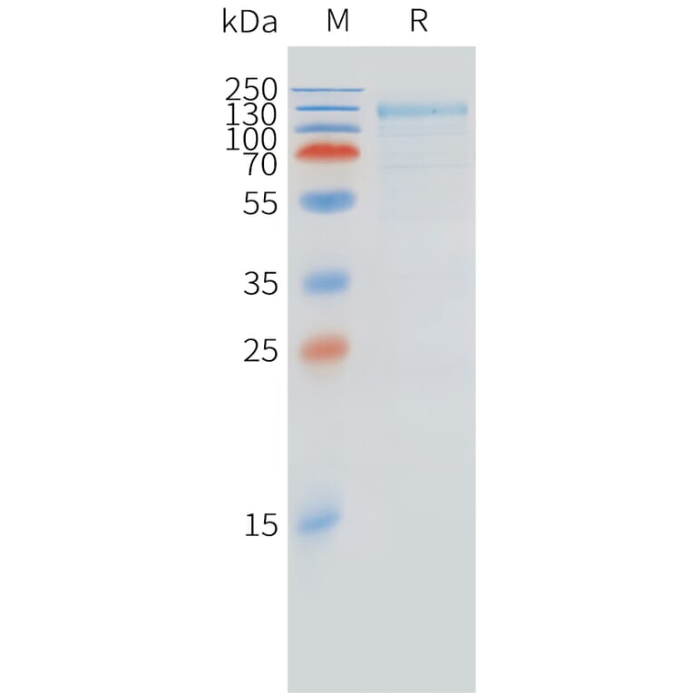 SDS-PAGE - Recombinant Cynomolgus macaque FCRL5 Protein (10xHis Tag) (A324718) - Antibodies.com