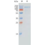 SDS-PAGE - Recombinant Cynomolgus macaque FCRL5 Protein (10xHis Tag) (A324718) - Antibodies.com