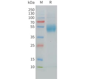 SDS-PAGE - Recombinant Cynomolgus macaque MICA Protein (10xHis Tag) (A324719) - Antibodies.com