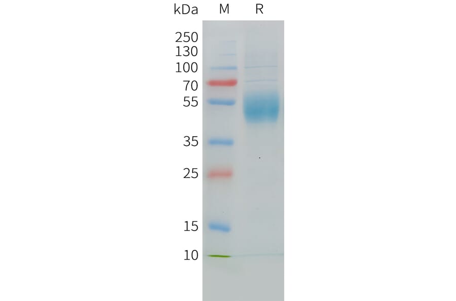 SDS-PAGE - Recombinant Cynomolgus macaque MICA Protein (10xHis Tag) (A324719) - Antibodies.com
