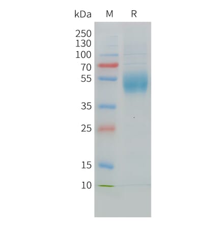 SDS-PAGE - Recombinant Cynomolgus macaque MICA Protein (10xHis Tag) (A324719) - Antibodies.com