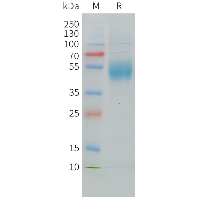 SDS-PAGE - Recombinant Cynomolgus macaque MICA Protein (10xHis Tag) (A324719) - Antibodies.com