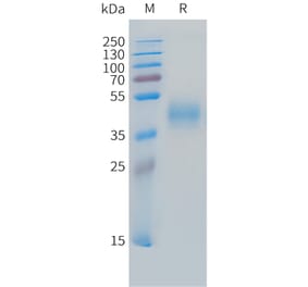 SDS-PAGE - Recombinant Cynomolgus macaque MICB Protein (10xHis Tag) (A324720) - Antibodies.com