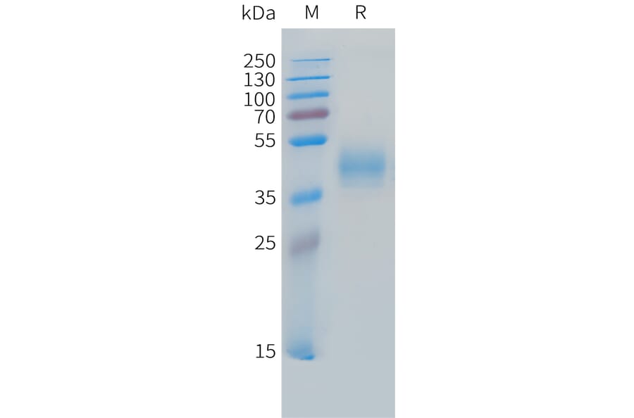 SDS-PAGE - Recombinant Cynomolgus macaque MICB Protein (10xHis Tag) (A324720) - Antibodies.com