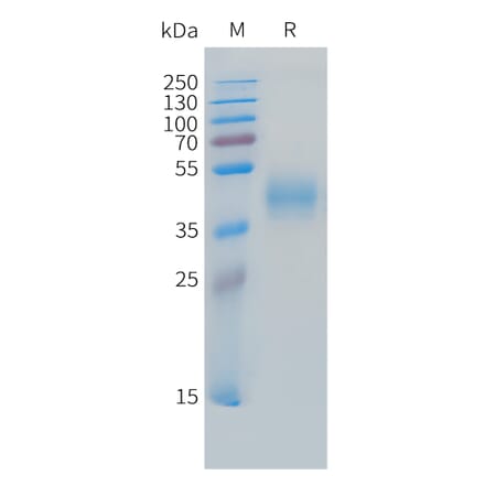 SDS-PAGE - Recombinant Cynomolgus macaque MICB Protein (10xHis Tag) (A324720) - Antibodies.com