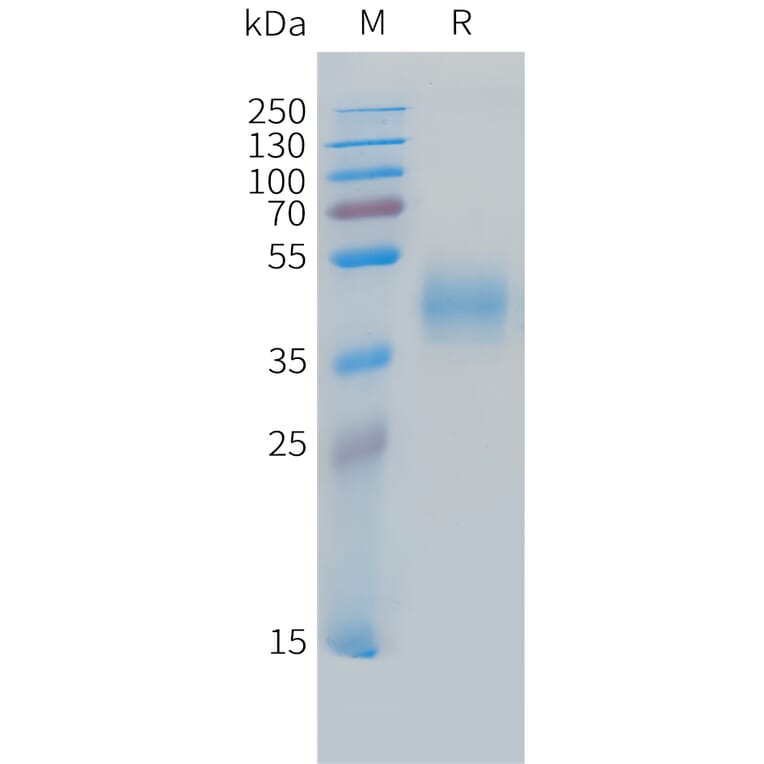 SDS-PAGE - Recombinant Cynomolgus macaque MICB Protein (10xHis Tag) (A324720) - Antibodies.com