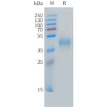 SDS-PAGE - Recombinant Cynomolgus macaque MICB Protein (10xHis Tag) (A324720) - Antibodies.com