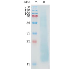 SDS-PAGE - Recombinant Cynomolgus macaque MUC1 Protein (10xHis Tag) (A324721) - Antibodies.com