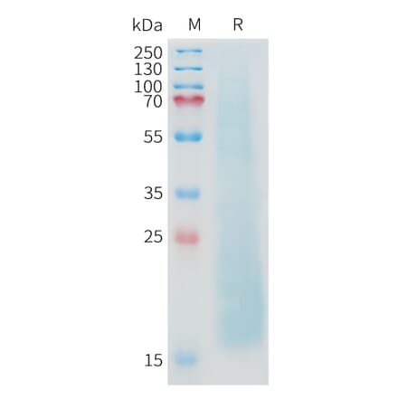 SDS-PAGE - Recombinant Cynomolgus macaque MUC1 Protein (10xHis Tag) (A324721) - Antibodies.com