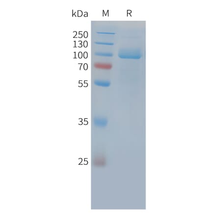 SDS-PAGE - Recombinant Cynomolgus macaque PSMA Protein (10xHis Tag) (A324723) - Antibodies.com