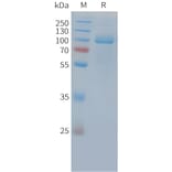 SDS-PAGE - Recombinant Cynomolgus macaque PSMA Protein (10xHis Tag) (A324723) - Antibodies.com