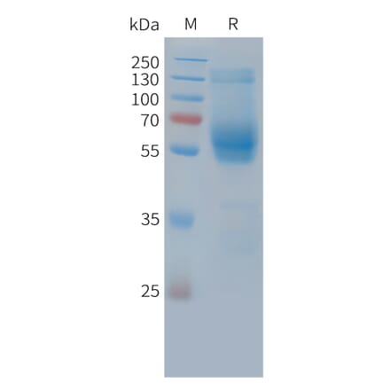 SDS-PAGE - Recombinant Cynomolgus macaque TIM3 Protein (Fc Tag) (A324724) - Antibodies.com