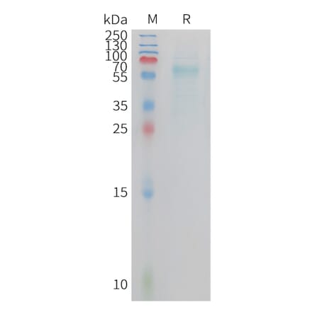 SDS-PAGE - Recombinant Cynomolgus macaque TREM2 Protein (Fc Tag) (A324726) - Antibodies.com