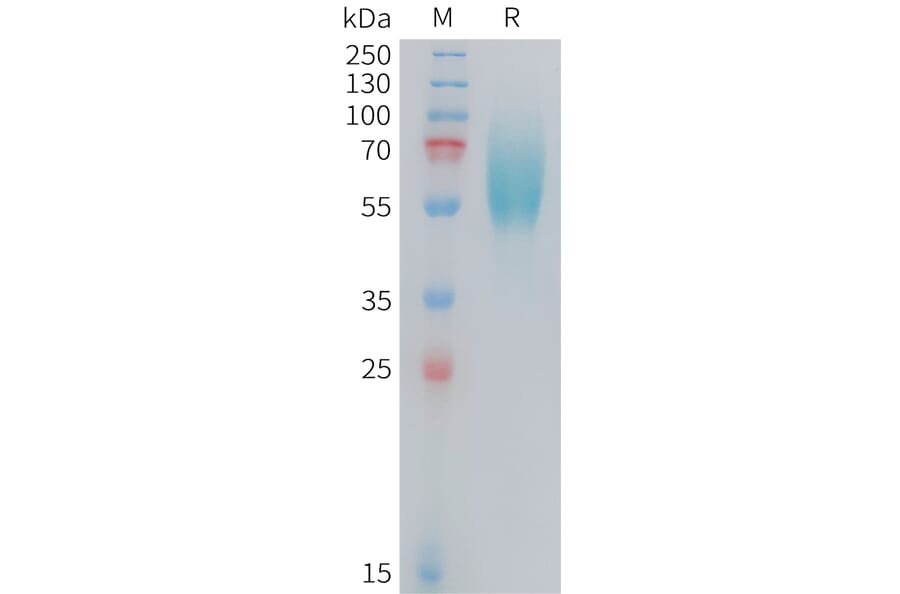 SDS-PAGE - Recombinant Human FGFR2IIIb Protein (10xHis Tag) (A324728) - Antibodies.com