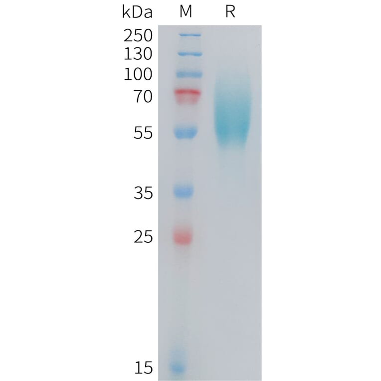 SDS-PAGE - Recombinant Human FGFR2IIIb Protein (10xHis Tag) (A324728) - Antibodies.com