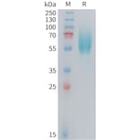 SDS-PAGE - Recombinant Human FGFR2IIIb Protein (10xHis Tag) (A324728) - Antibodies.com