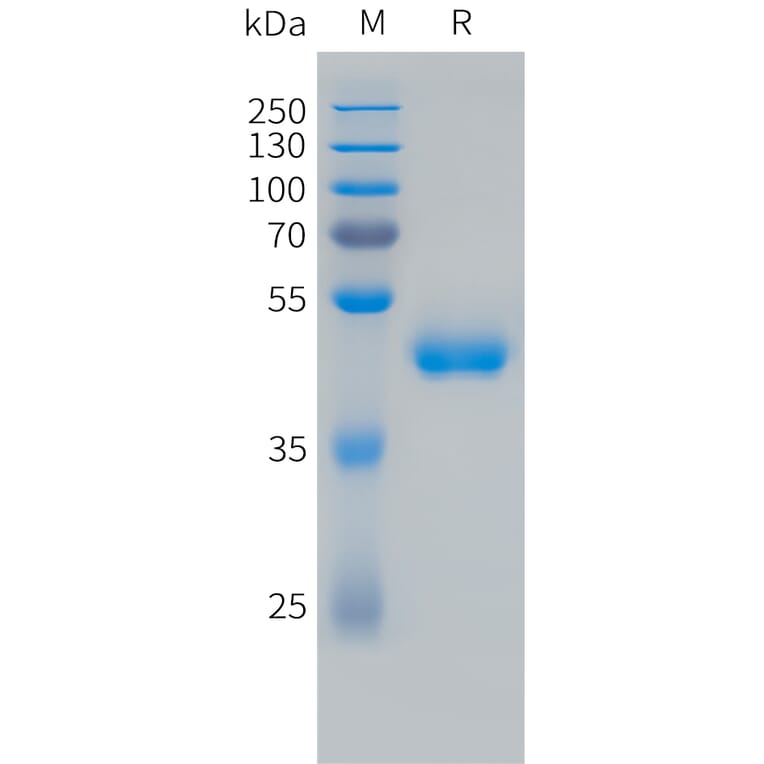 SDS-PAGE - Recombinant Human VEGF121 Protein (Fc Tag) (A324731) - Antibodies.com