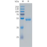 SDS-PAGE - Recombinant Human VEGF165 Protein (Fc Tag) (A324732) - Antibodies.com