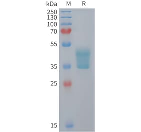 SDS-PAGE - Recombinant Mouse CCR2 Protein (Fc Tag) (A324733) - Antibodies.com