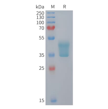 SDS-PAGE - Recombinant Mouse CCR2 Protein (Fc Tag) (A324733) - Antibodies.com