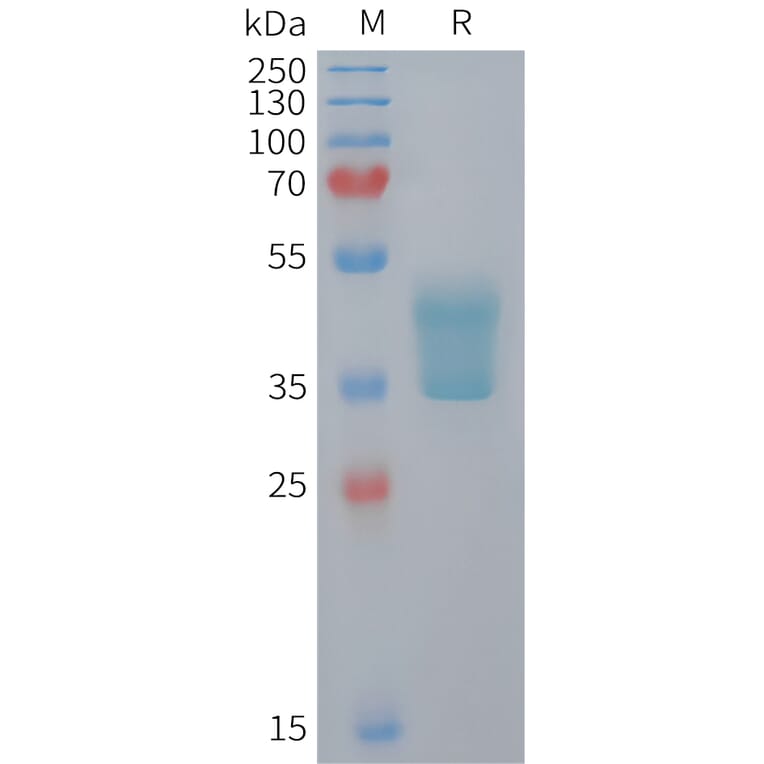 SDS-PAGE - Recombinant Mouse CCR2 Protein (Fc Tag) (A324733) - Antibodies.com