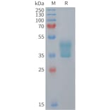SDS-PAGE - Recombinant Mouse CCR2 Protein (Fc Tag) (A324733) - Antibodies.com