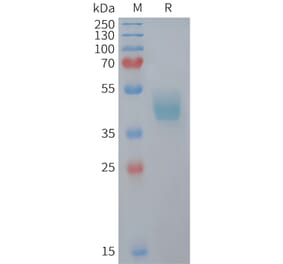 SDS-PAGE - Recombinant Mouse CCR6 Protein (Fc Tag) (A324734) - Antibodies.com