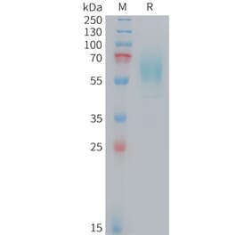 SDS-PAGE - Recombinant Mouse CD98 Protein (10xHis Tag) (A324735) - Antibodies.com