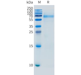 SDS-PAGE - Recombinant Mouse FCRL5 Protein (10xHis Tag) (A324736) - Antibodies.com
