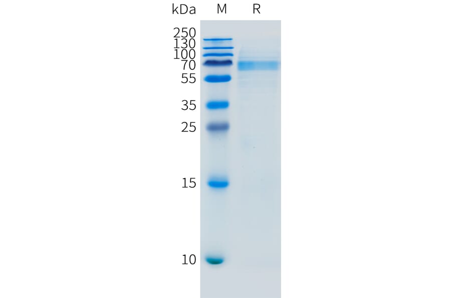 SDS-PAGE - Recombinant Mouse FCRL5 Protein (10xHis Tag) (A324736) - Antibodies.com