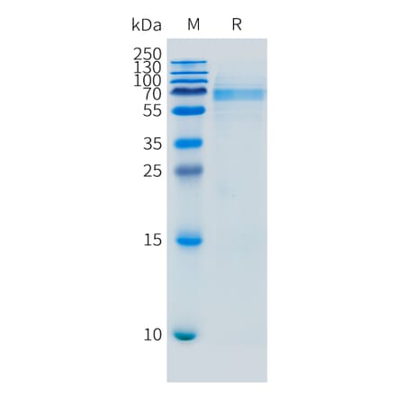 SDS-PAGE - Recombinant Mouse FCRL5 Protein (10xHis Tag) (A324736) - Antibodies.com